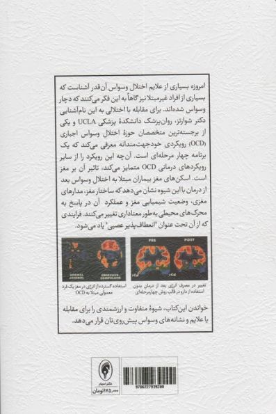 قفل گشایی از مغز وسواسی