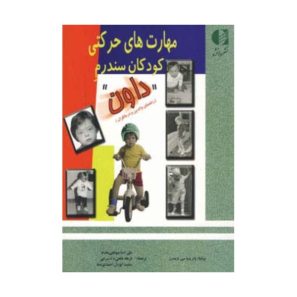 مهارت های حرکتی کودکان سندرم داون
