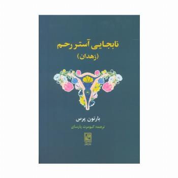نابجایی آستر رحم (زهدان)