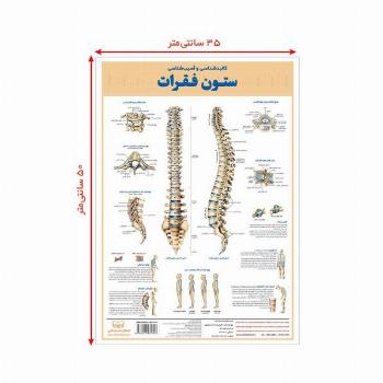 پوستر کالبد شناسی و آسیب شناسی ستون فقرات 50*35 (گلاسه،باجعبه)