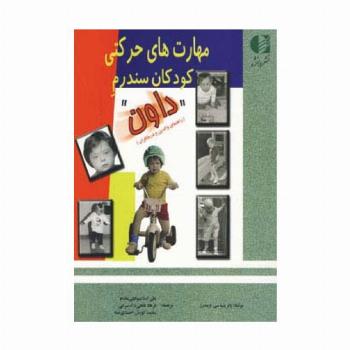 مهارت های حرکتی کودکان سندرم داون